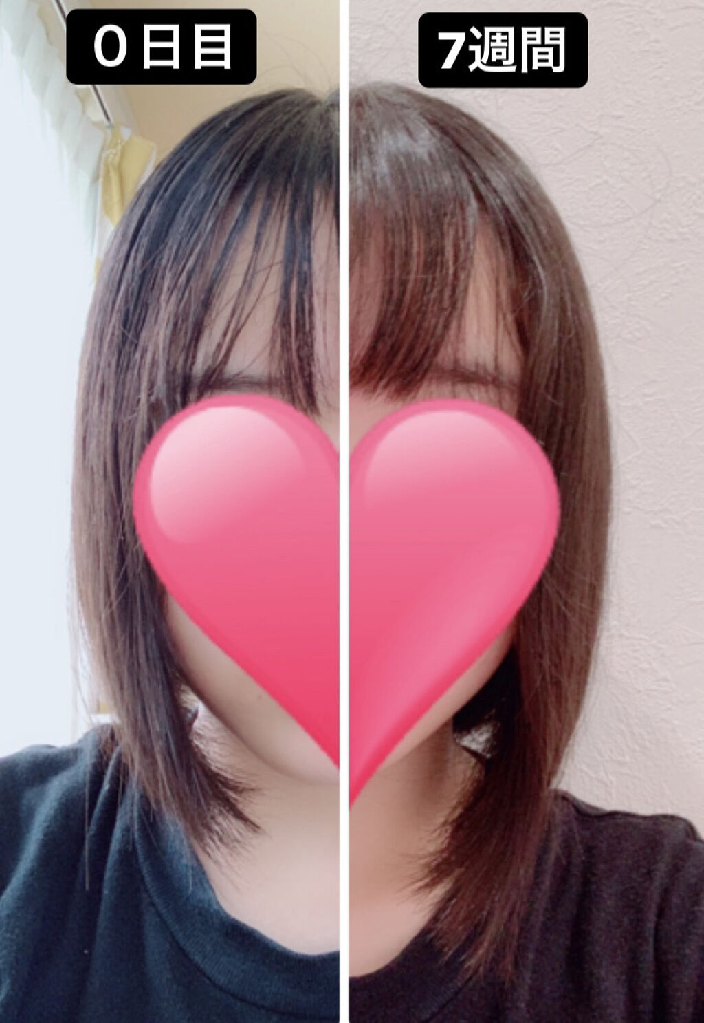 ヘアアクセルレーター フローラルの香り/加美乃素本舗/頭皮ローションを使ったクチコミ（1枚目）