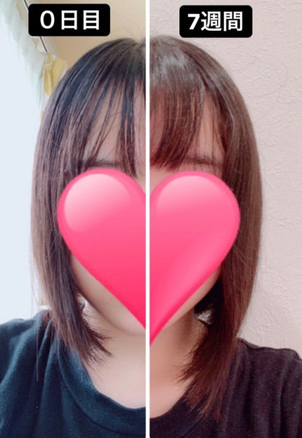 ヘアアクセルレーター フローラルの香り/加美乃素本舗/頭皮ローションを使ったクチコミ(1枚目)