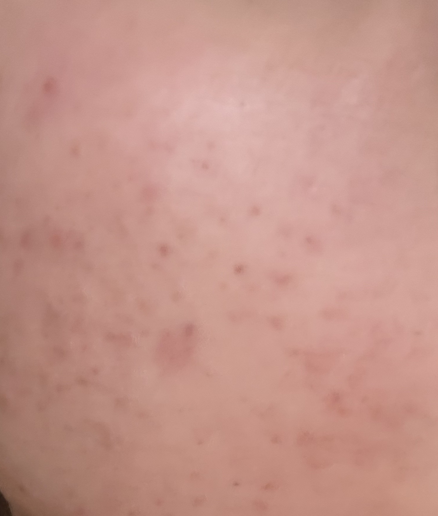 クリアフル ディープクレンジングリキッド/オルビス/クレンジングウォーターを使ったクチコミ（3枚目）