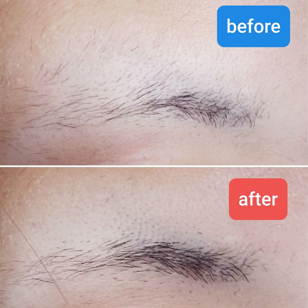 プレミア敏感肌用 Lディスポ/シック/シェーバーを使ったクチコミ(2枚目)