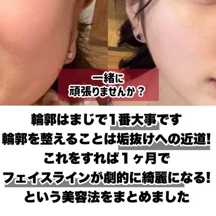 クラブ ホルモンクリームのクチコミ「【まじで試してみて】1ヶ月でフェイスラインを劇的に綺麗にする方法㊙️⬇️
騙されたと思って試.....」(2枚目)