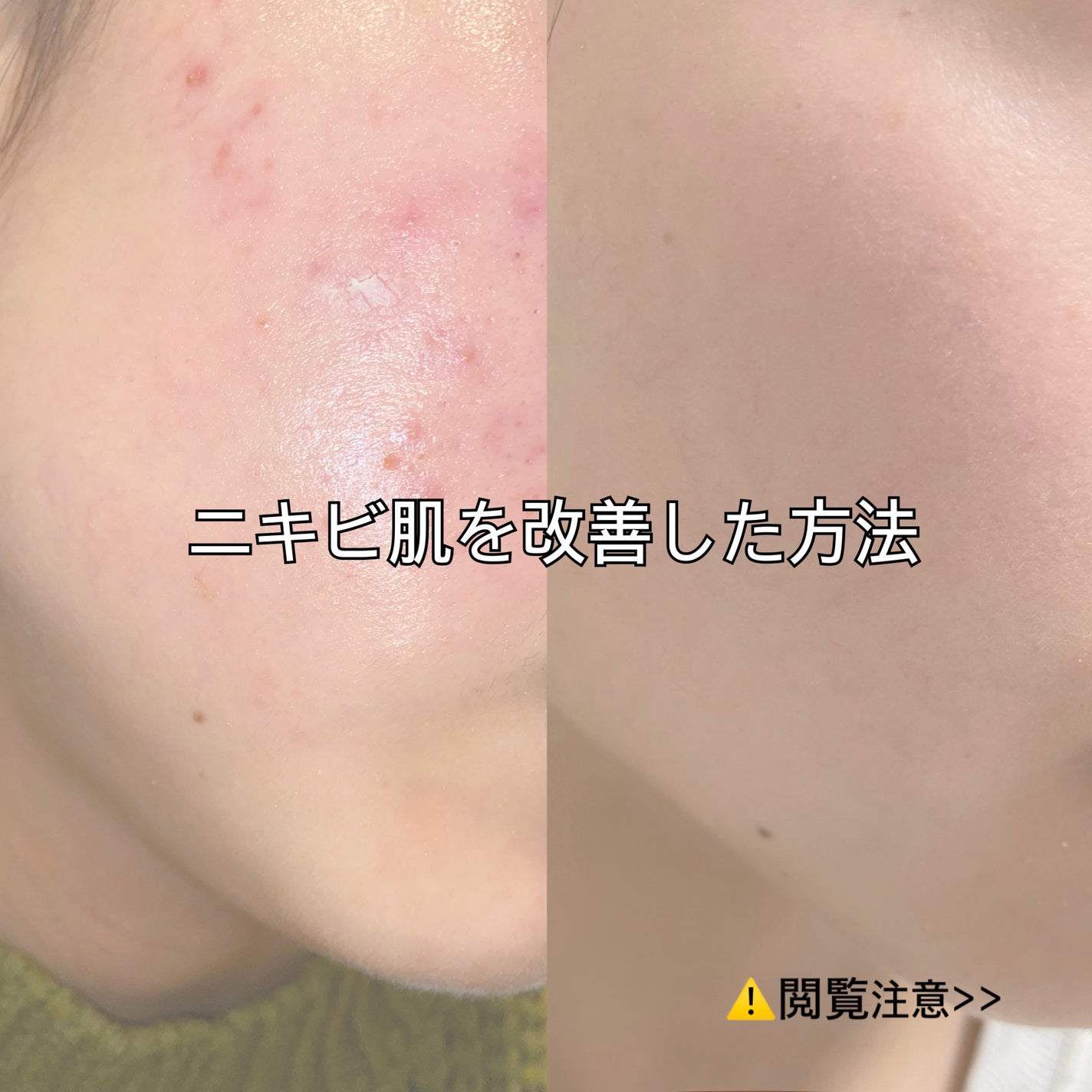 デュオ ザ クレンジングバーム クリア/DUO/クレンジングバームを使ったクチコミ(1枚目)