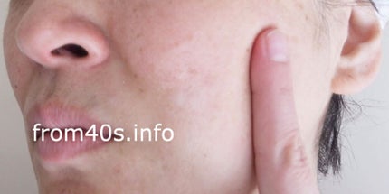 シルククリーム/エルツティン/美容液を使ったクチコミ(4枚目)