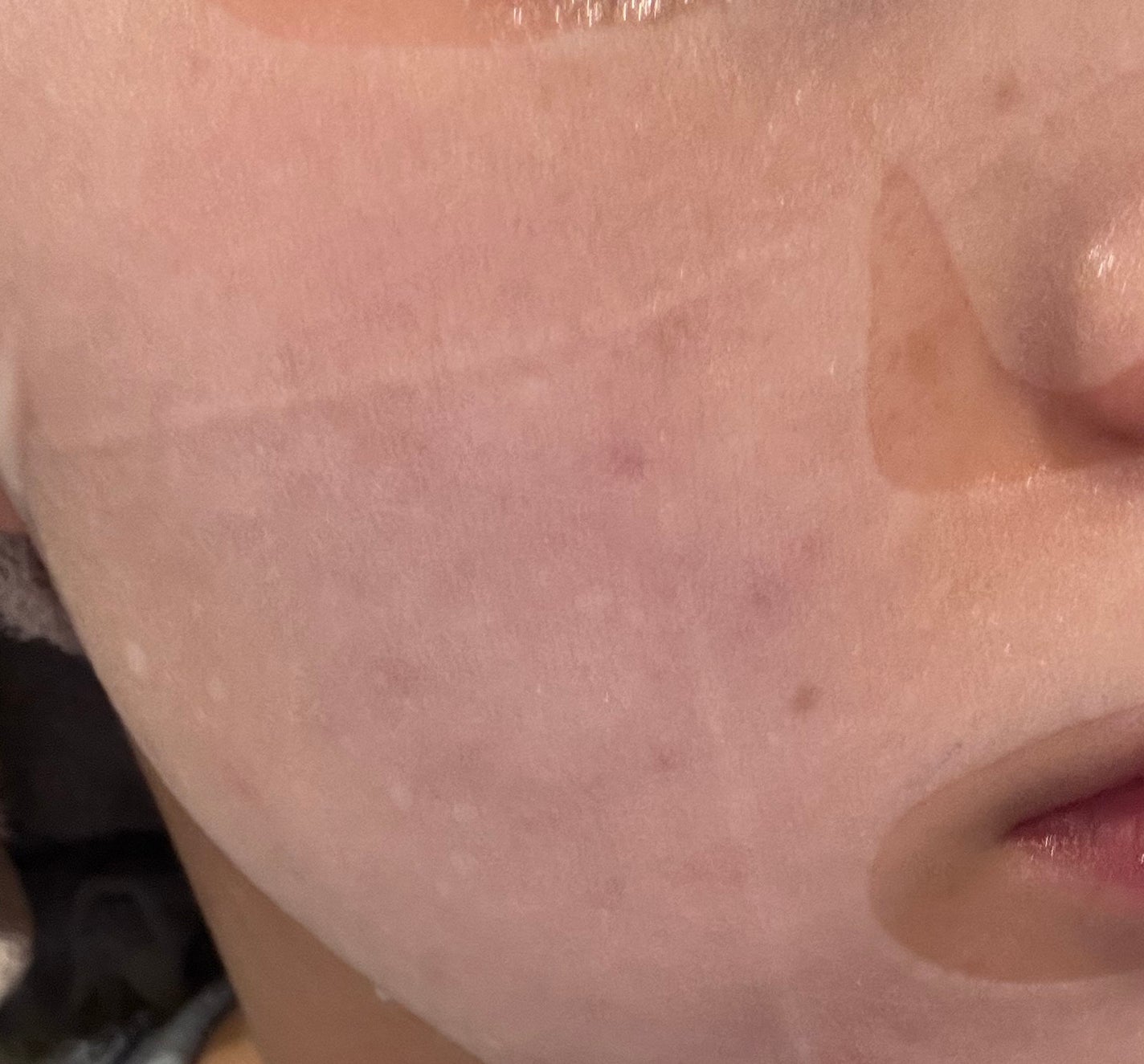 ナイアシンアミドレシピ ホワイトマスク/Dr.Oracle/シートマスク・パックを使ったクチコミ(3枚目)