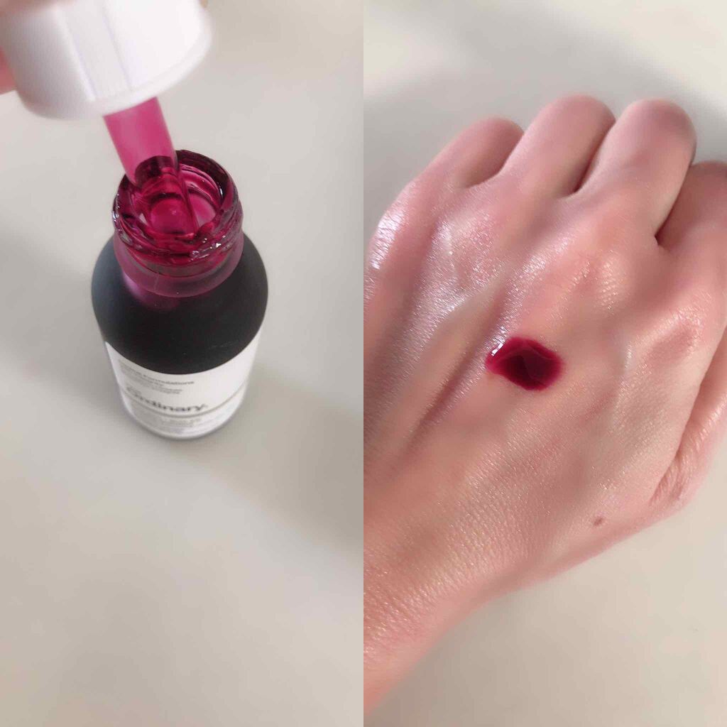 AHA 30% + BHA 2% Peeling Solution/The Ordinary/ピーリングを使ったクチコミ（2枚目）