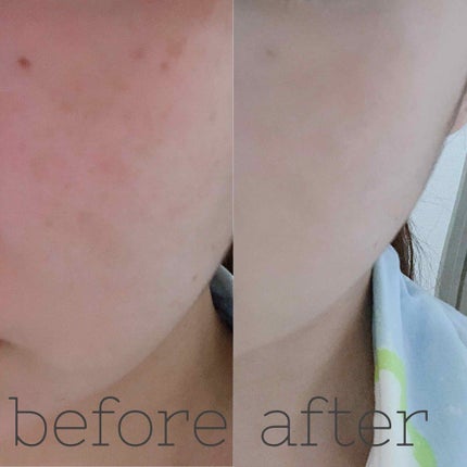 を使ったクチコミ(2枚目)