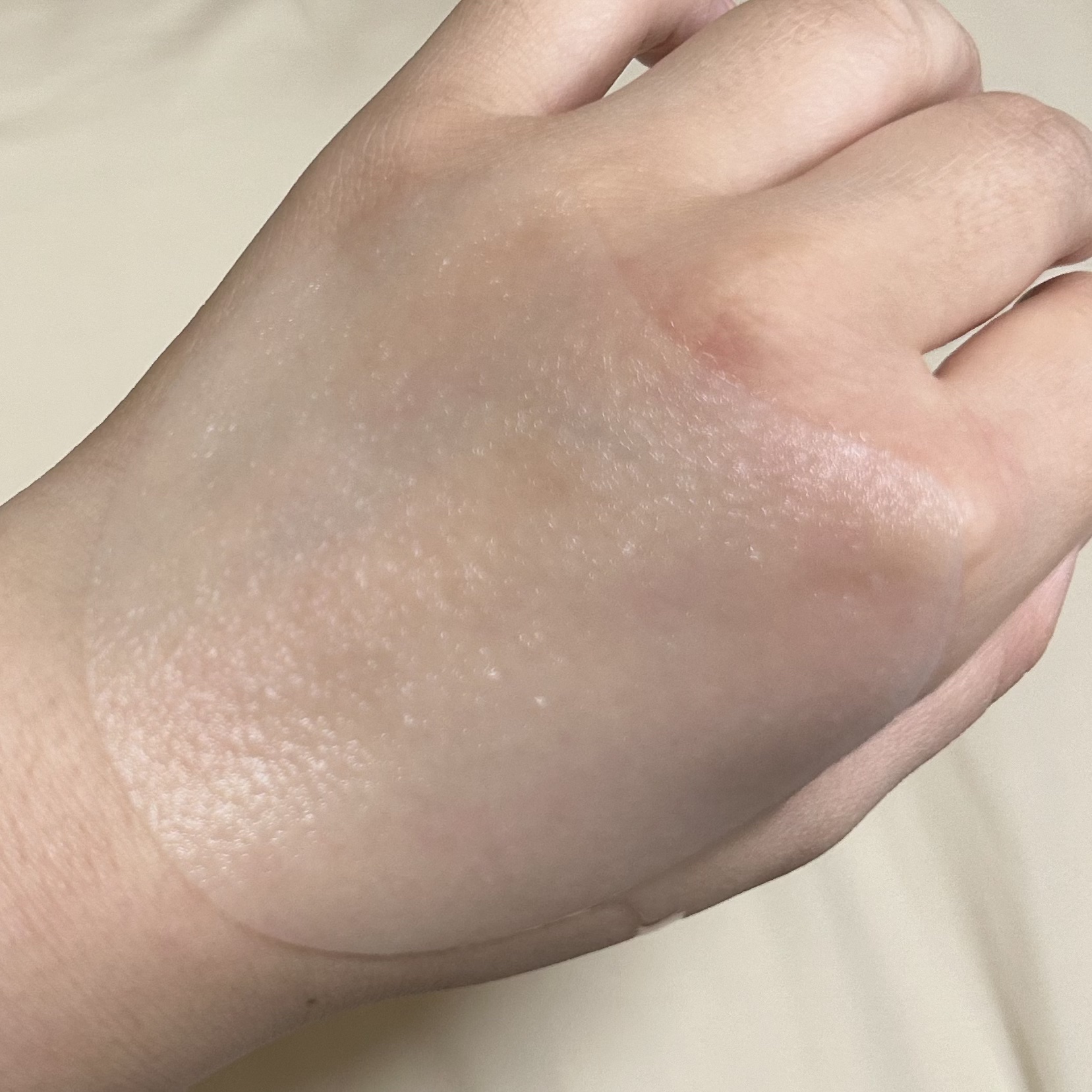 ティーツリカ リリーフ アンプル/SKIN1004/美容液を使ったクチコミ（3枚目）