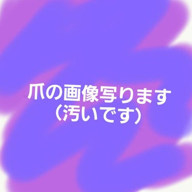 ウィンマックス ネイルケアシリーズ ベースコート/DAISO/ネイルトップコート・ベースコートを使ったクチコミ（2枚目）