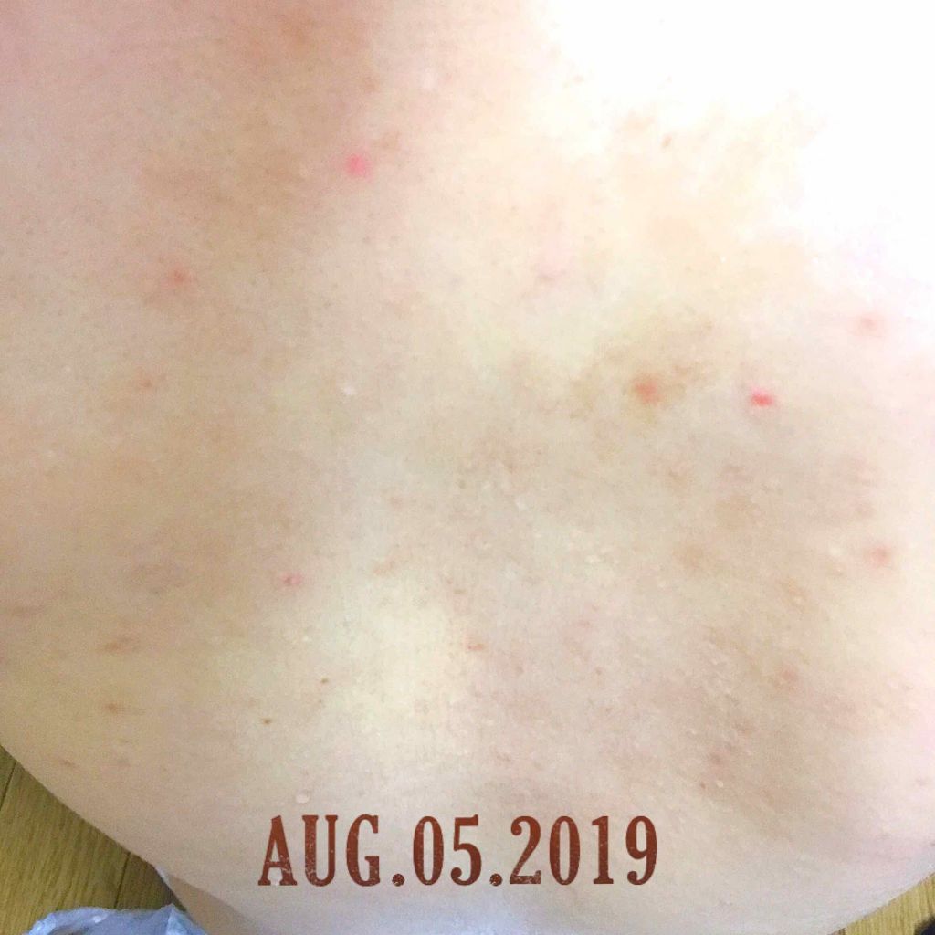 セナキュア(医薬品)/小林製薬/その他を使ったクチコミ(3枚目)