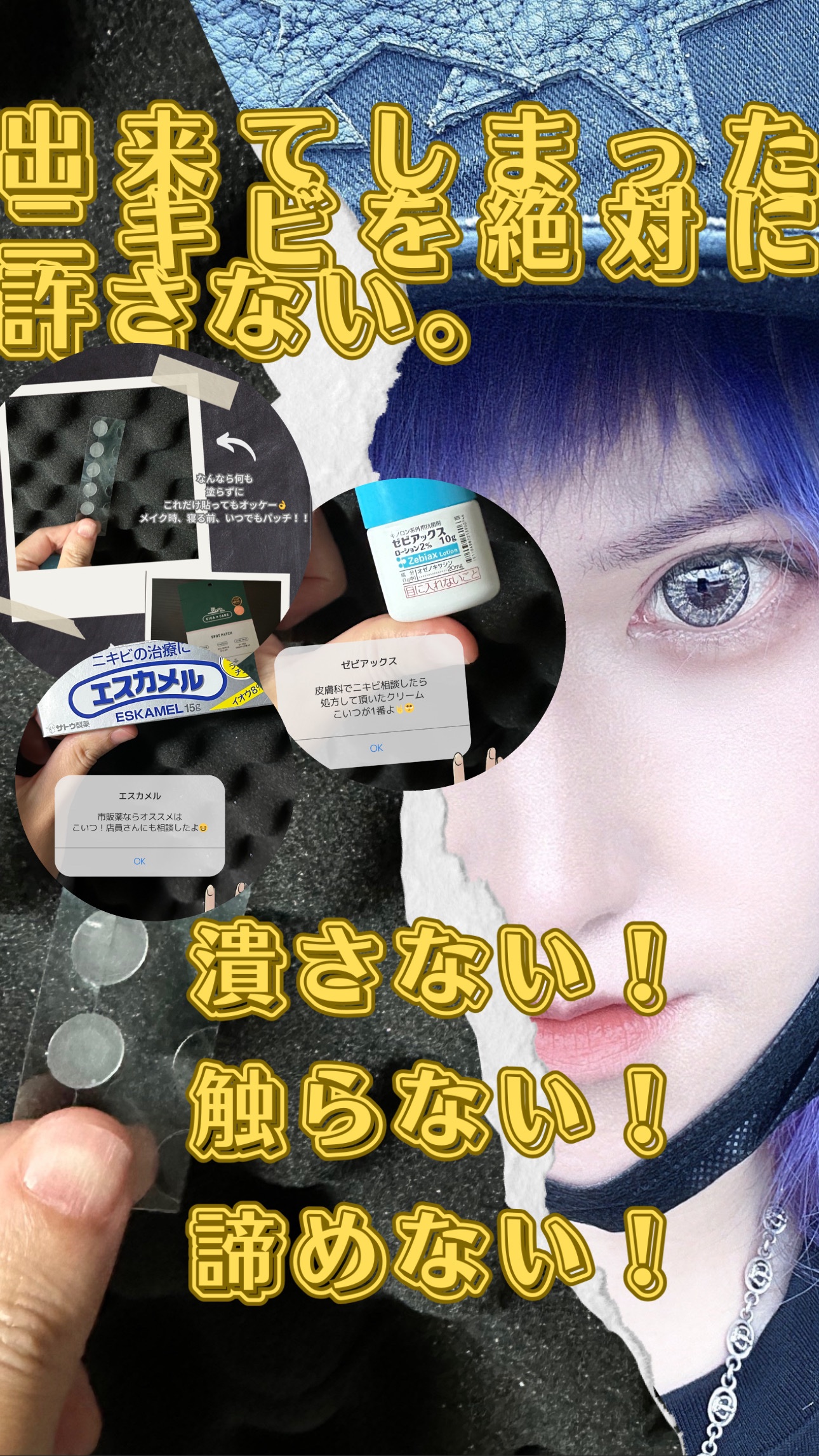 出来たニキビに責任取れる男に俺ぁなりてぇ....

･*:.｡. ☆☆.｡.:*･゜ﾟ･*:.｡. ☆☆.｡.:*･゜ﾟ･*:.｡. ☆☆.｡.:*･゜

【塗り薬】

1️⃣ゼビアックス

抗菌薬であり、アクネ菌の増殖を抑え赤ニキビに効果