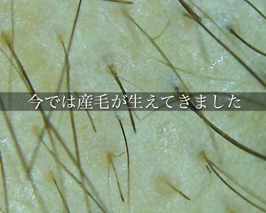 黒髪スカルプ・プロ/haru/シャンプー・コンディショナーを使ったクチコミ（2枚目）