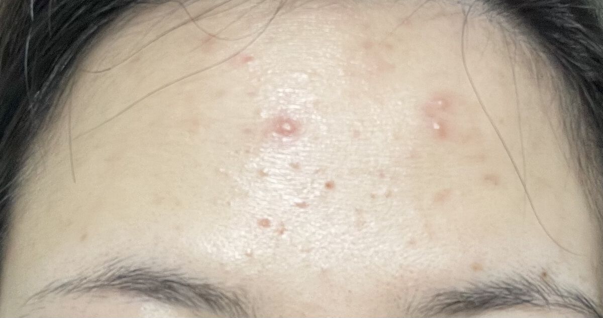 ザビタミンC23/IOPE/美容液を使ったクチコミ（2枚目）