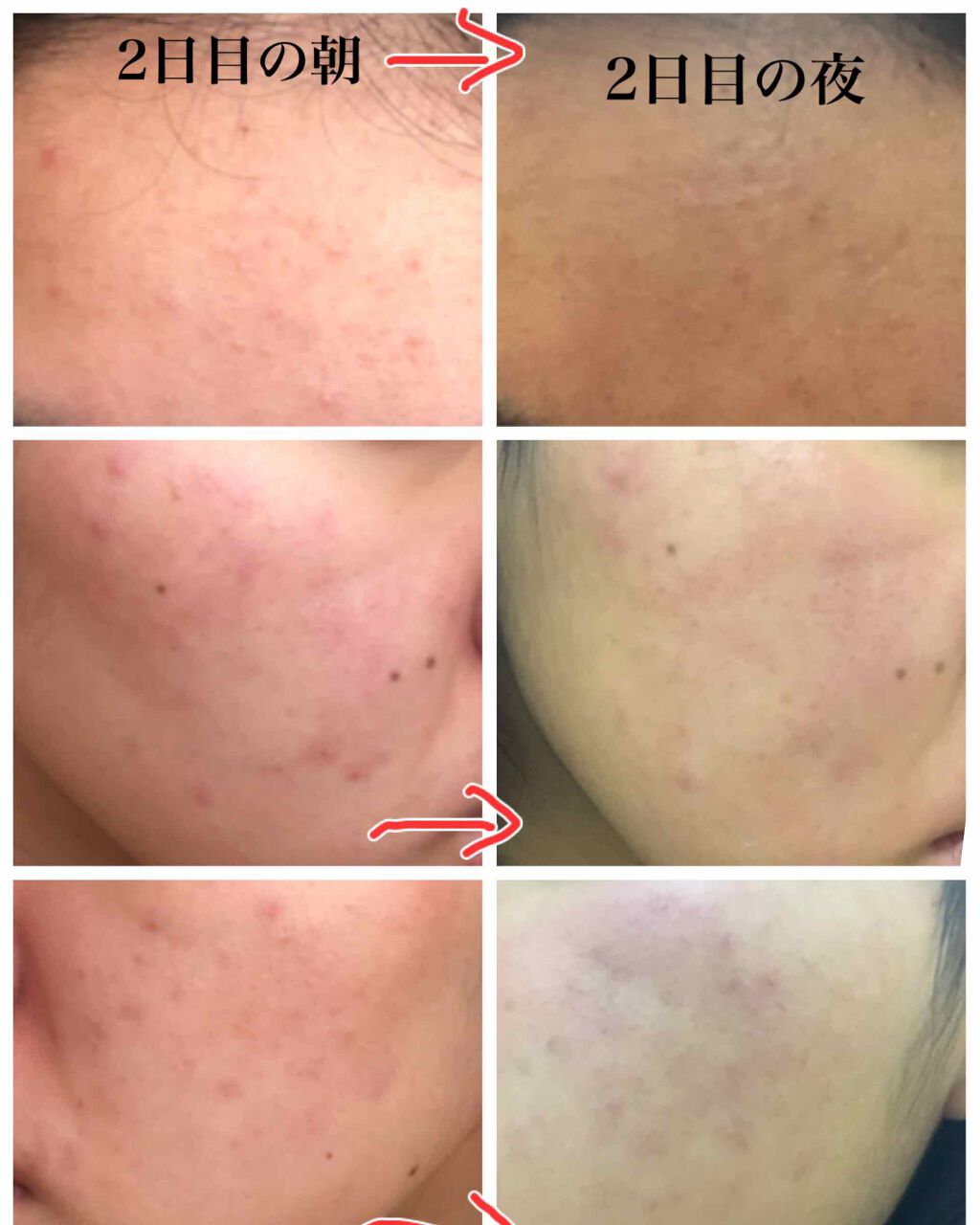 ハトムギ化粧水(ナチュリエ スキンコンディショナー R )/ナチュリエ/化粧水を使ったクチコミ(1枚目)