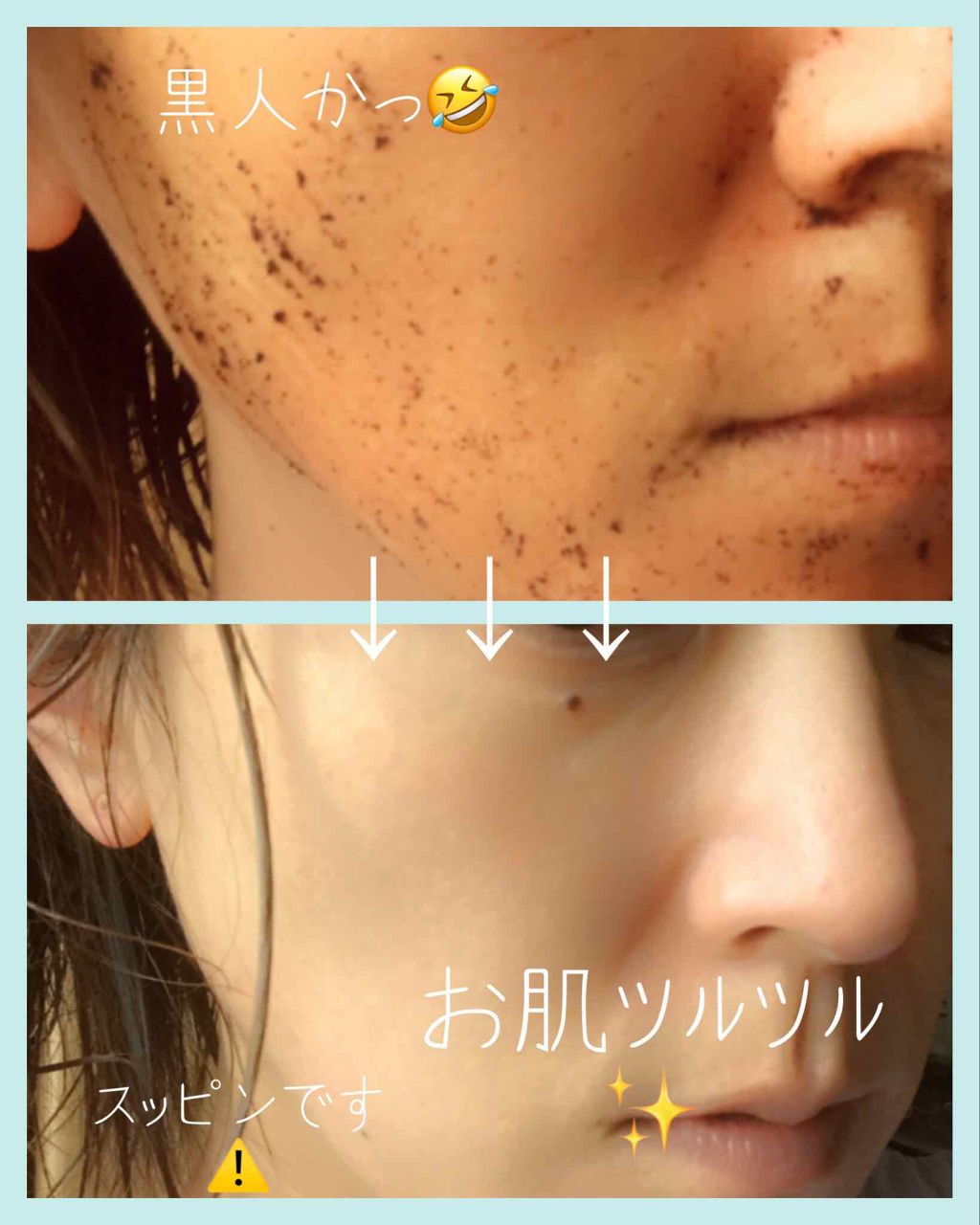 ピーリングビーン/エー・エス・エー/ピーリングを使ったクチコミ(4枚目)