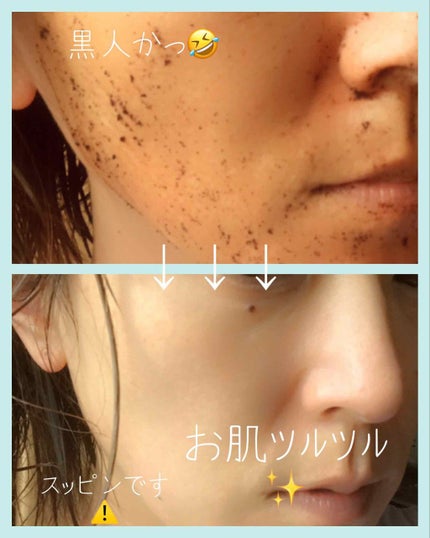 ピーリングビーン/エー・エス・エー/ピーリングを使ったクチコミ(4枚目)