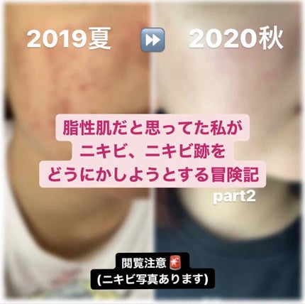 薬用しみ対策 美白化粧水/メラノCC/化粧水を使ったクチコミ(1枚目)