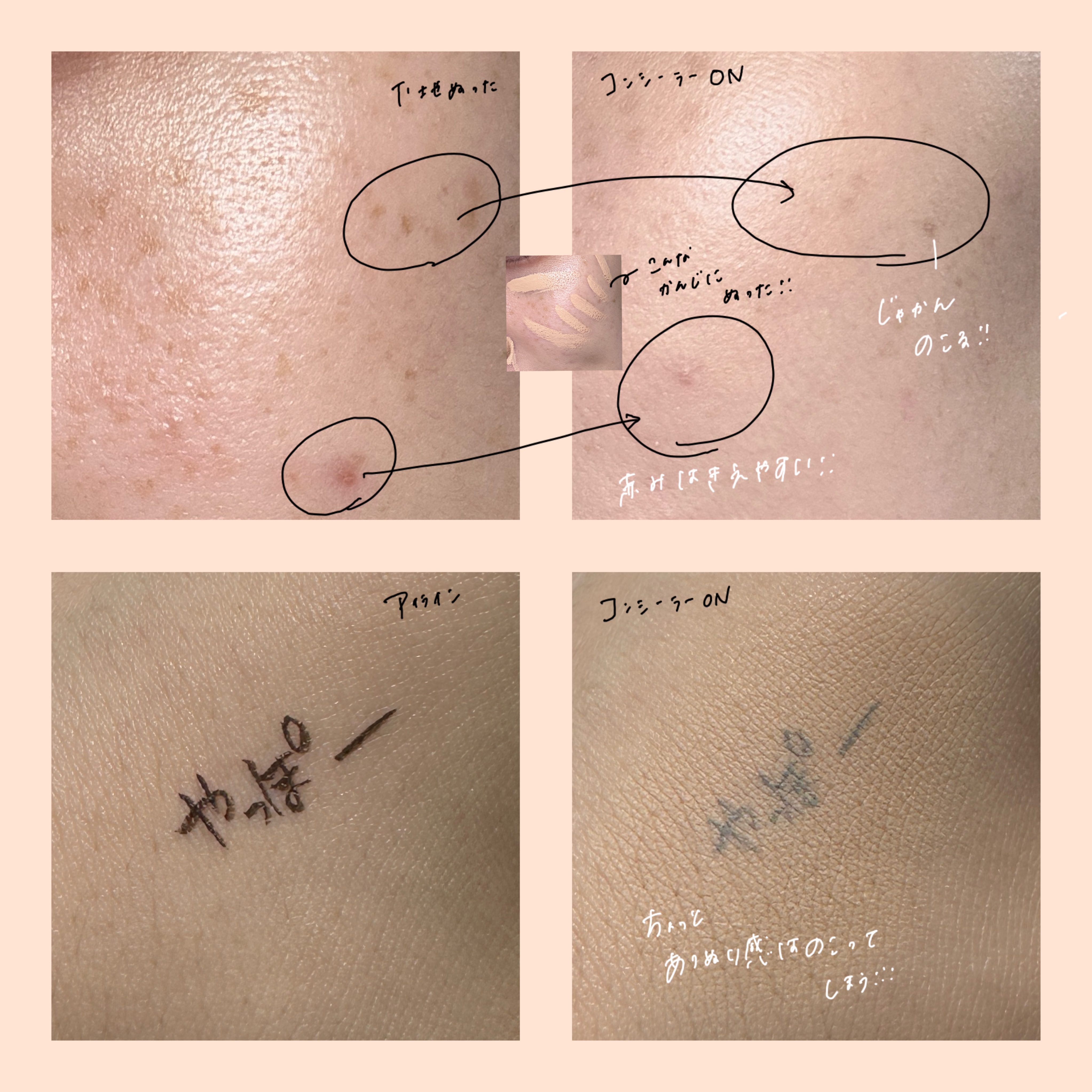 ロングラスティングチップコンシーラーフィックシングフィット/LUNA/リキッドコンシーラーを使ったクチコミ（2枚目）