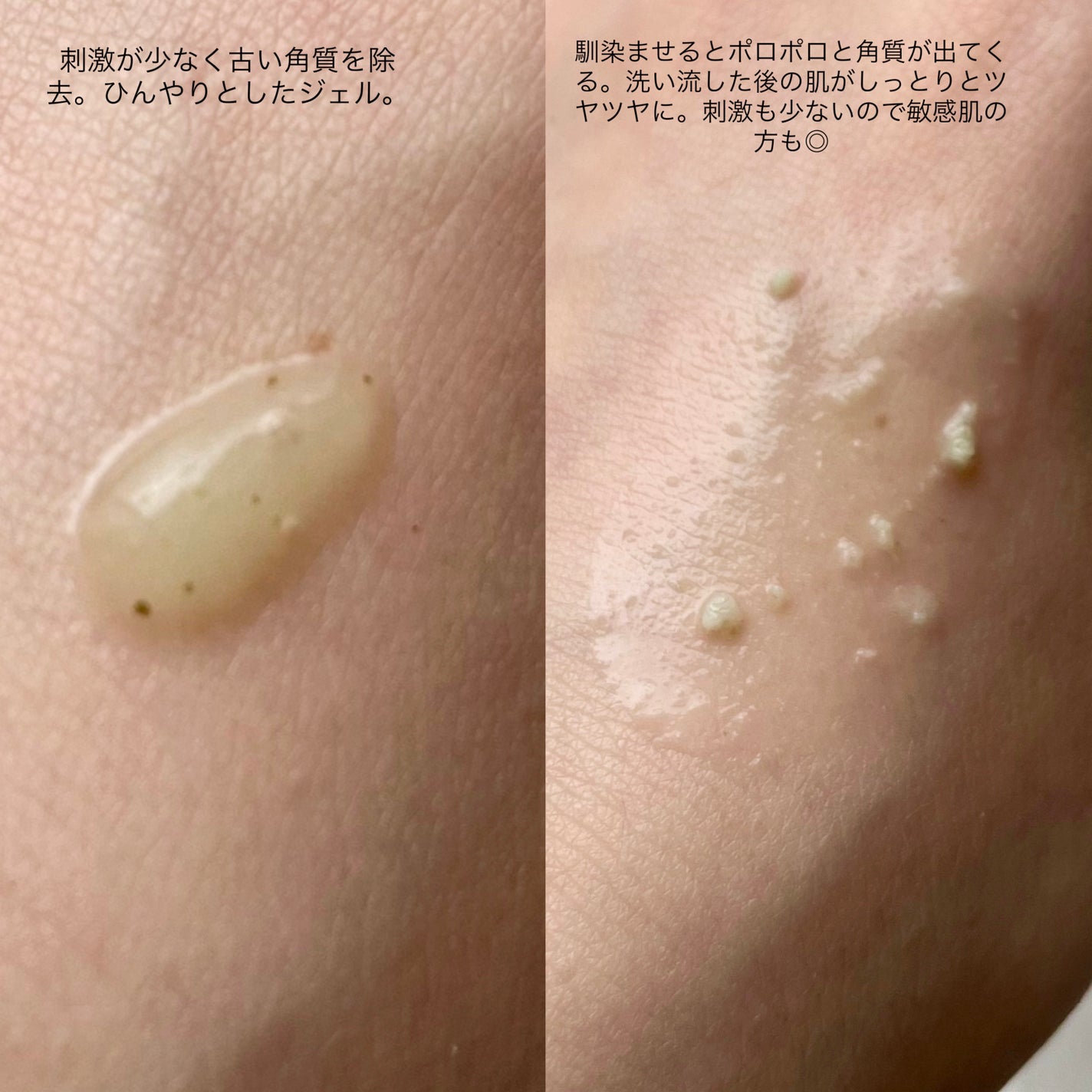 クリーンイットゼロポアティーツリーピーリングジェル/BANILA CO/ピーリングを使ったクチコミ(2枚目)