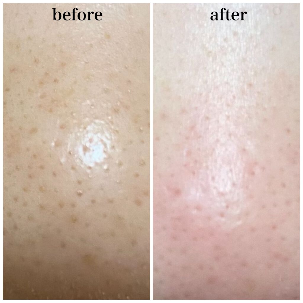 ノーモアブラックヘッド(ノーズピーリング)/One-day's you/スクラブ・ゴマージュを使ったクチコミ(3枚目)