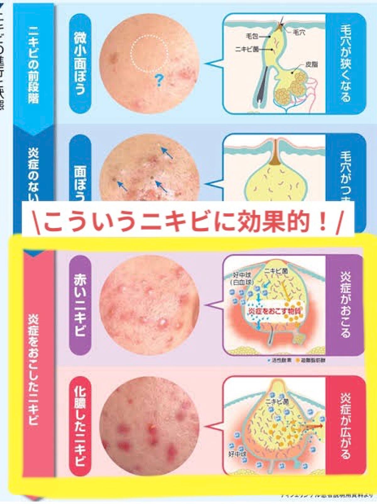 テラ・コートリル 軟膏(医薬品)/ジョンソン・エンド・ジョンソン/その他を使ったクチコミ(2枚目)