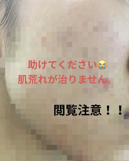 敏感肌用薬用美白美容液/無印良品/美容液を使ったクチコミ(1枚目)
