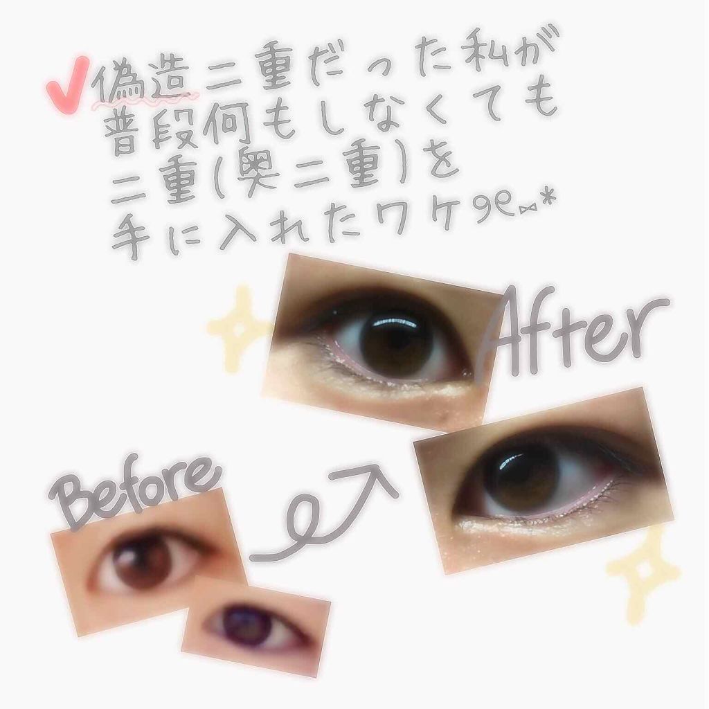 アイテープ 埋没式両面テープ/DAISO/二重まぶた用アイテムを使ったクチコミ（1枚目）