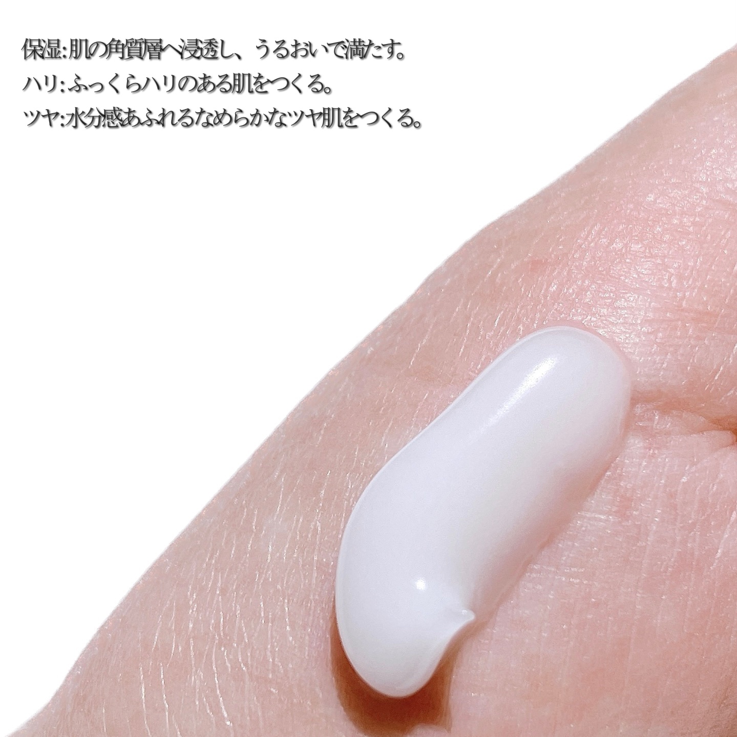 ウォータードロップスージングクリーム/Acne Cat/フェイスクリームを使ったクチコミ（2枚目）