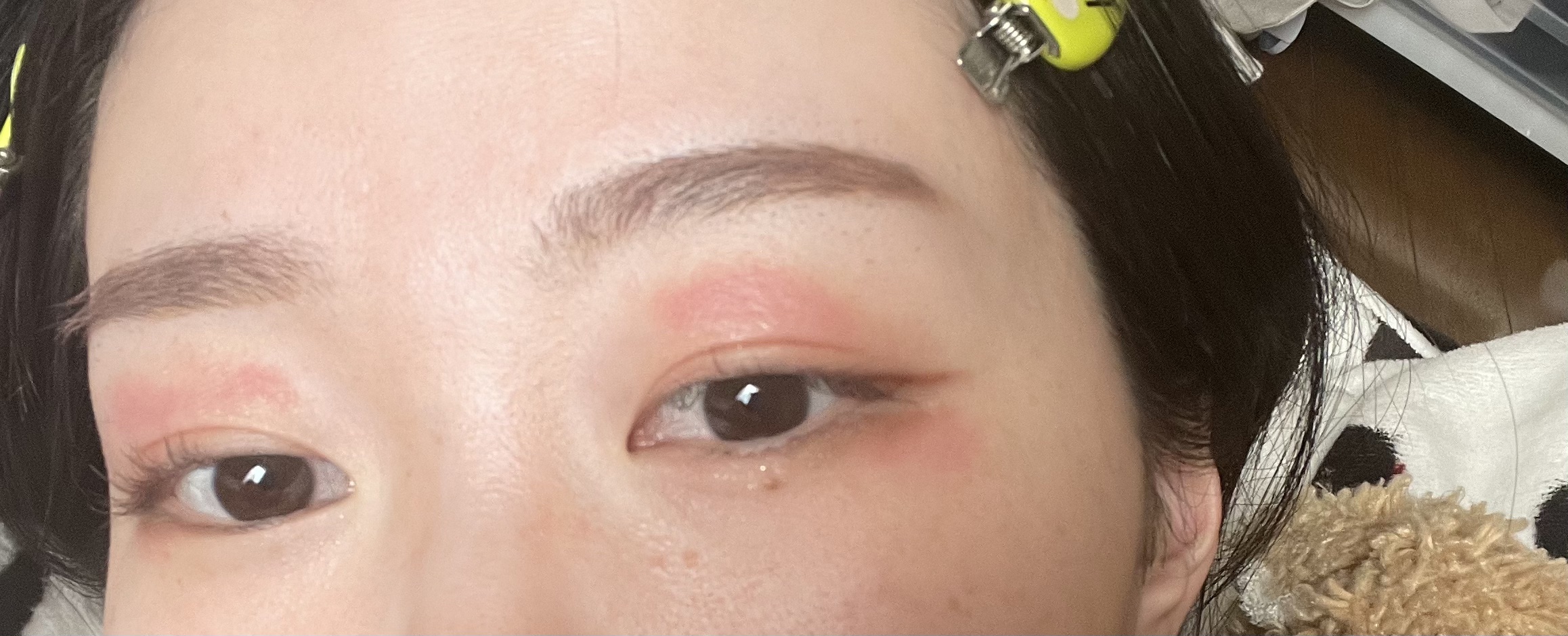 マイティアアイテクトアルピタット(医薬品)/マイティア/その他を使ったクチコミ（3枚目）