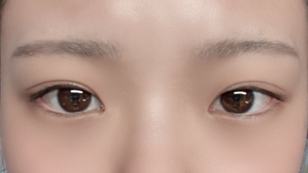 オリシキ アイリッドスキンフィルム /D-UP/二重まぶた用アイテムを使ったクチコミ(2枚目)