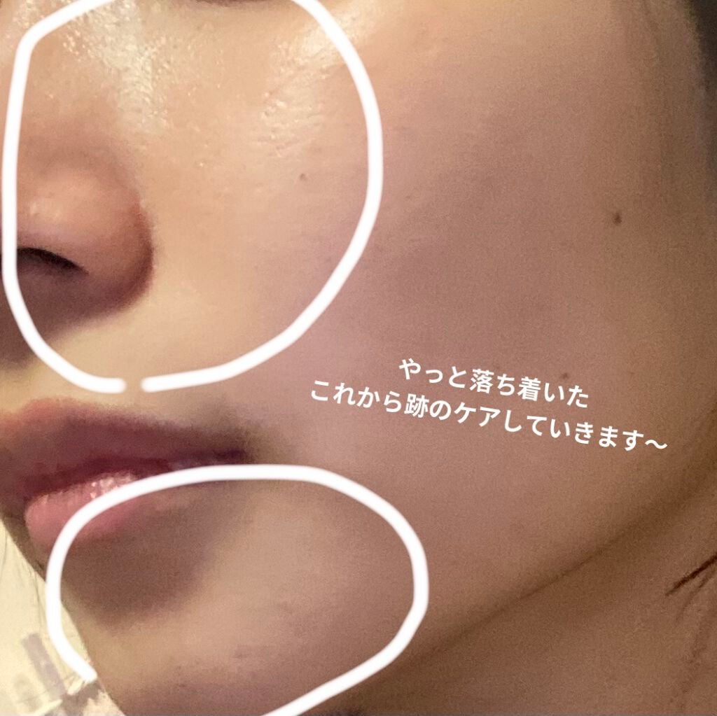 ニベアクリーム/ニベア/ボディクリームを使ったクチコミ(4枚目)