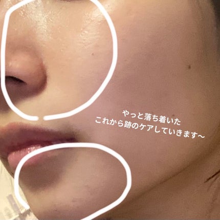 ニベアクリーム/ニベア/ボディクリームを使ったクチコミ(4枚目)