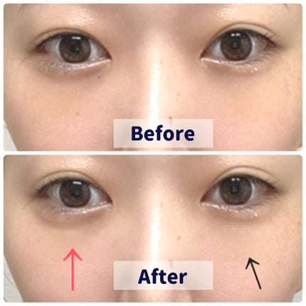 ビオパフォーマンス セカンドスキン トライアルキット/SHISEIDO/トライアルキットを使ったクチコミ(5枚目)