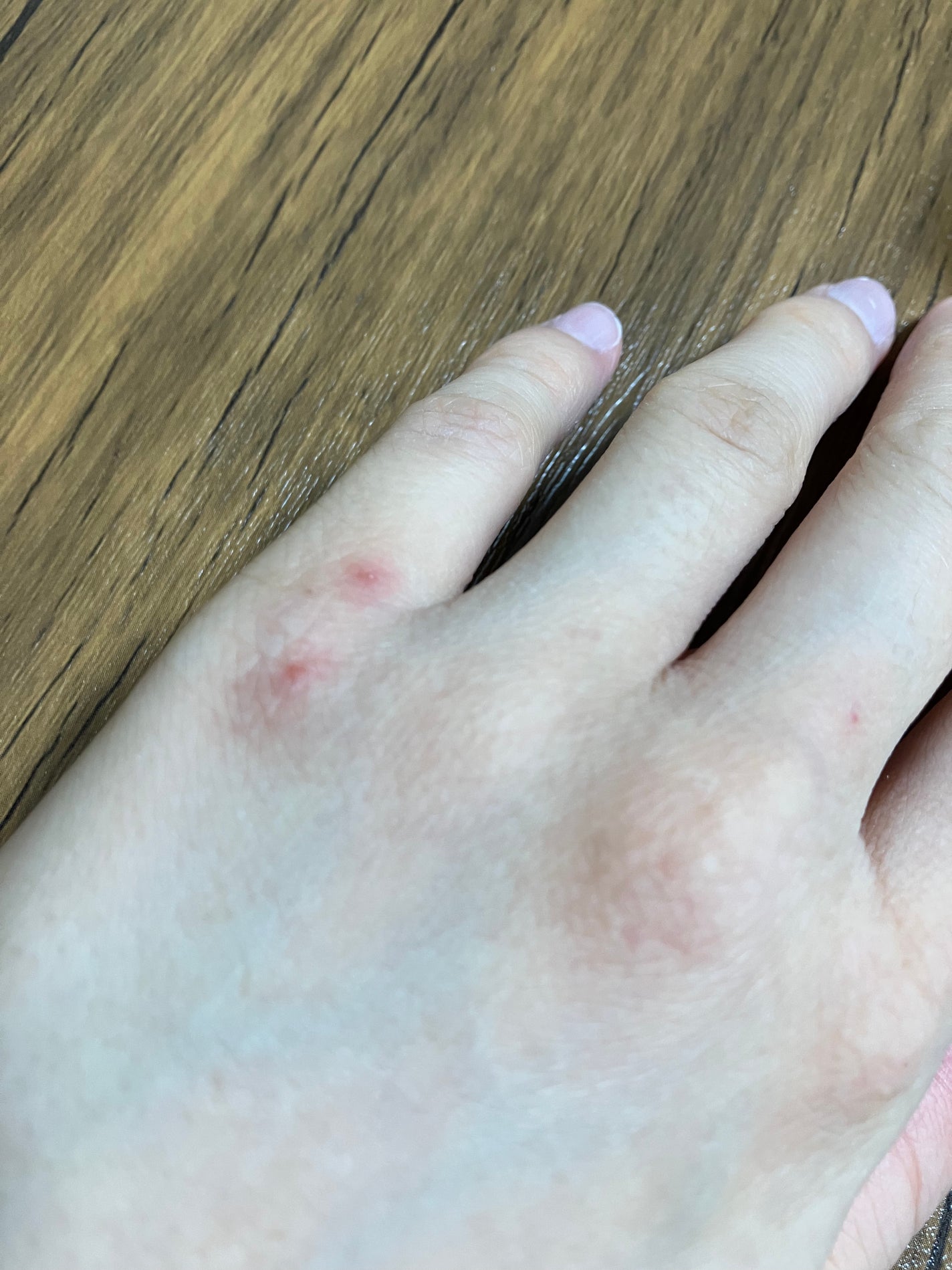 ヴェールヌーディ エッセンスパクトグロウ/AGE20’s/クリーム・エマルジョンファンデーションを使ったクチコミ(2枚目)