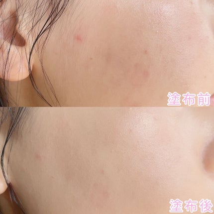 ピンクティーツリーカバークッション/APLIN/クッションファンデーションを使ったクチコミ(7枚目)