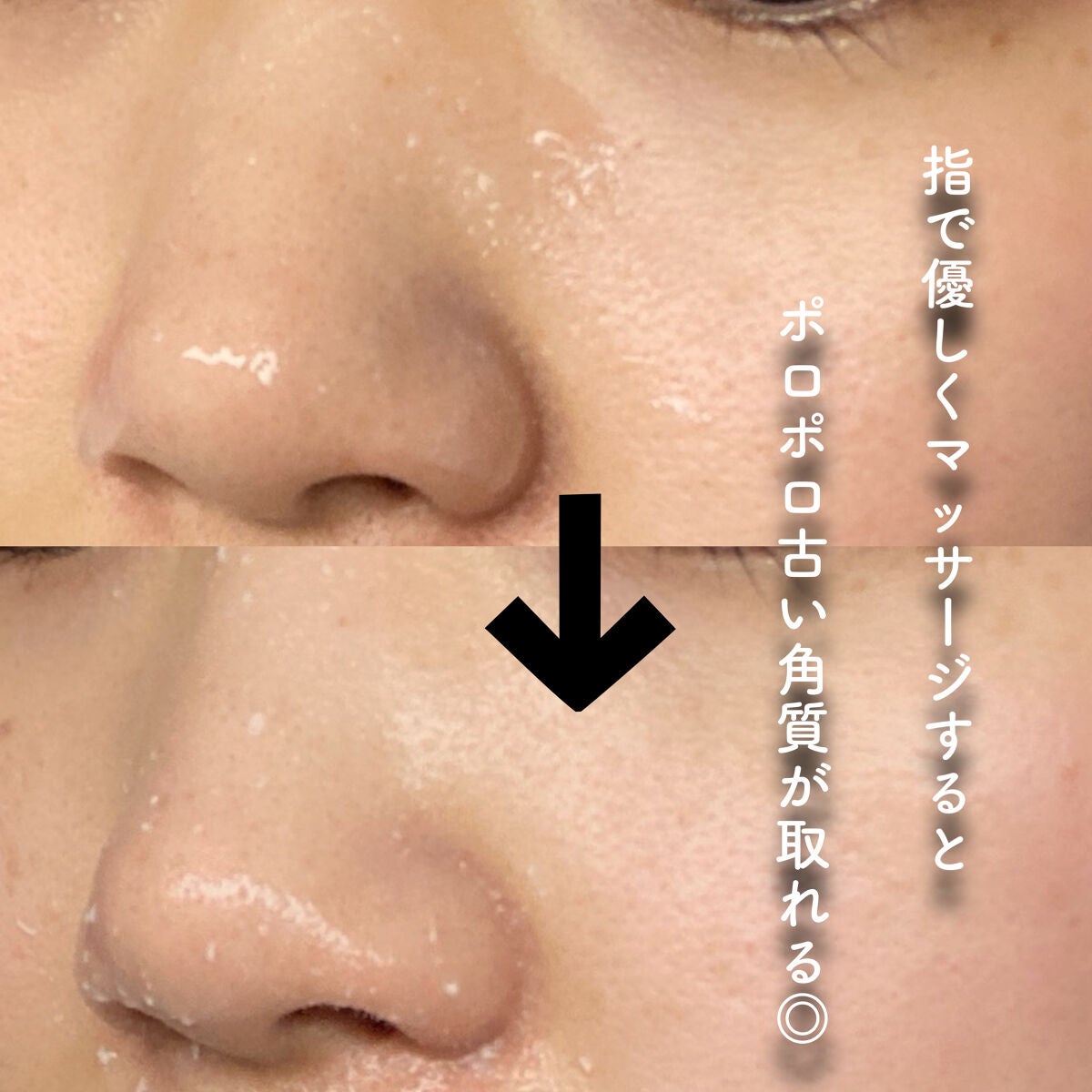 コスメジタン 薬用美白ハナビジン/シーヴァ/スクラブ・ゴマージュを使ったクチコミ(4枚目)