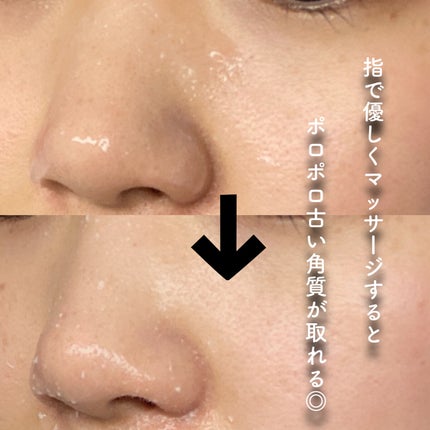 コスメジタン 薬用美白ハナビジン/シーヴァ/スクラブ・ゴマージュを使ったクチコミ(4枚目)