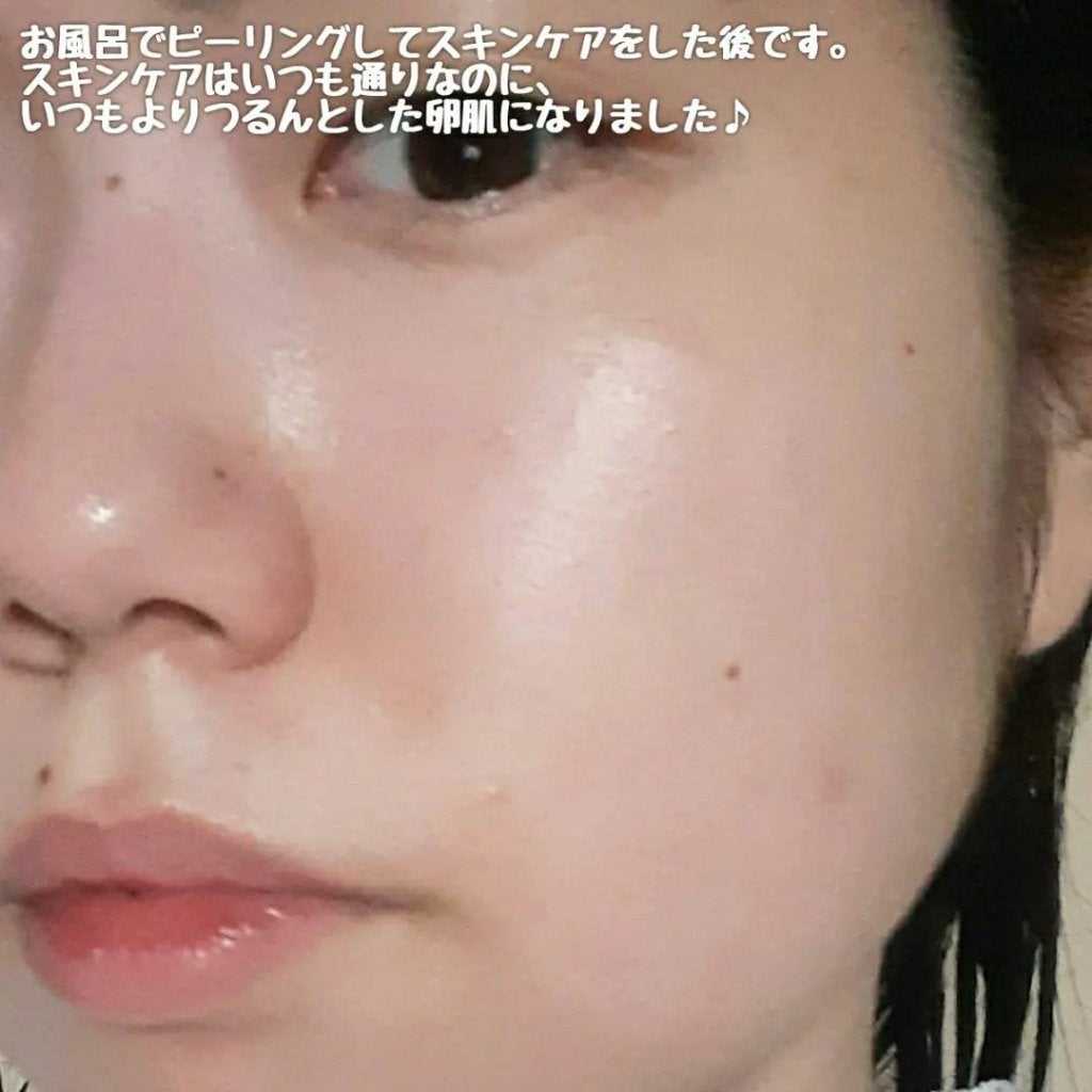 ブライトニングピーリングジェル/Dr.G/ピーリングを使ったクチコミ(7枚目)