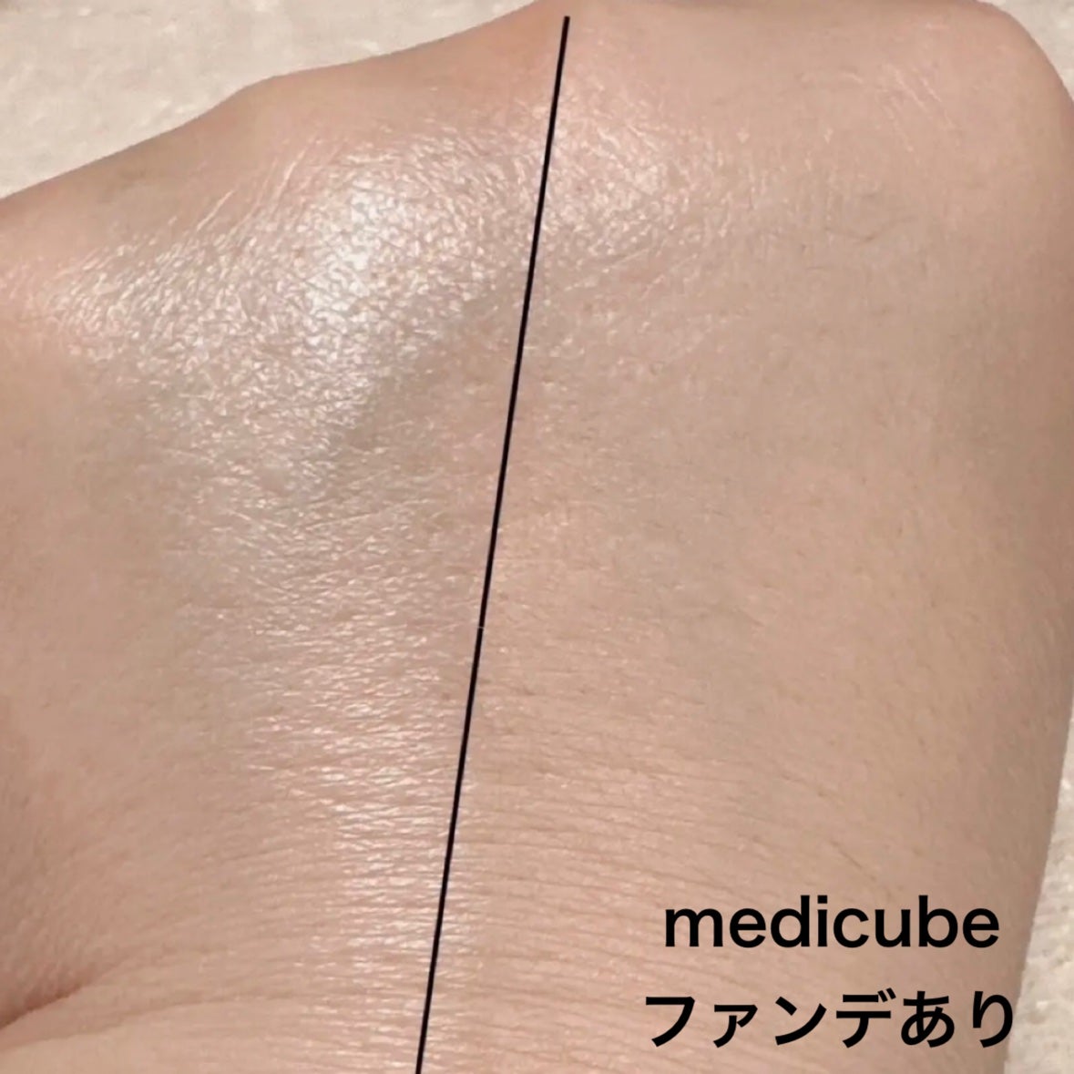 ブラック クッション/HERA/クッションファンデーションを使ったクチコミ(9枚目)