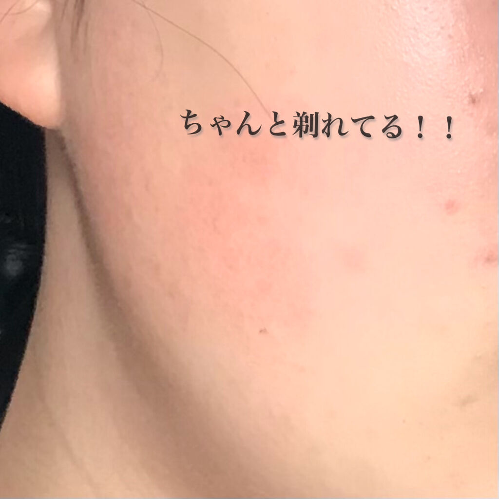 長柄カミソリ ビューティーM /貝印/シェーバーを使ったクチコミ（3枚目）