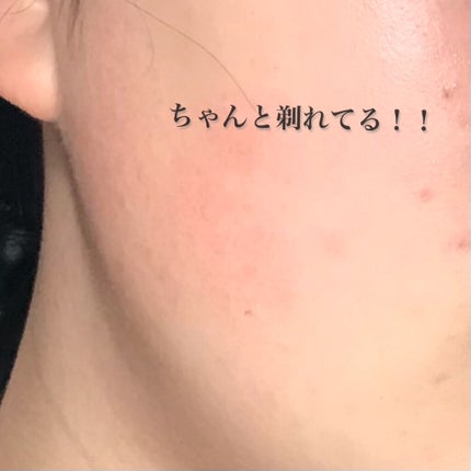 長柄カミソリ ビューティーM /貝印/シェーバーを使ったクチコミ(3枚目)