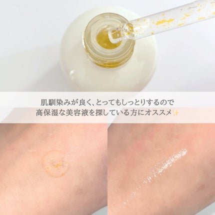 Eちゃん フォロバ♡ on LIPS 「【速報‼︎】イニスフリーから豪華でお得なスキンケアセット「朝ビ..」(5枚目)