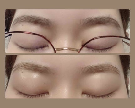 脱色クリーム 敏感肌用/エピラット/ムダ毛ケアを使ったクチコミ(1枚目)