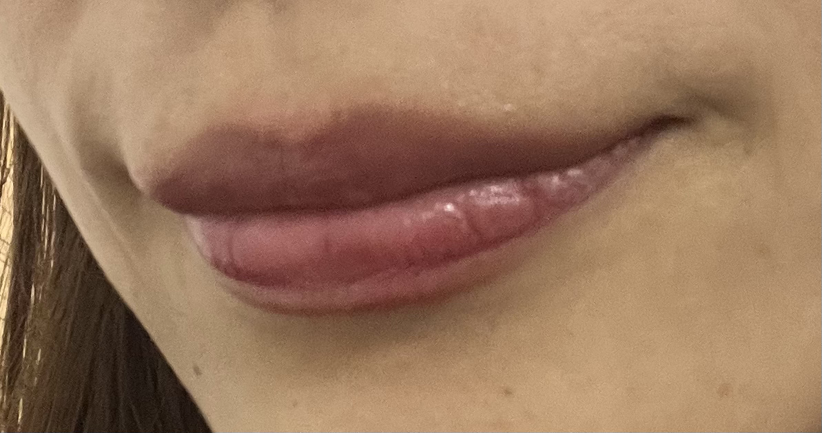 エクシア AL リップトリートメント 4-D/ALBION/リップ美容液を使ったクチコミ（1枚目）