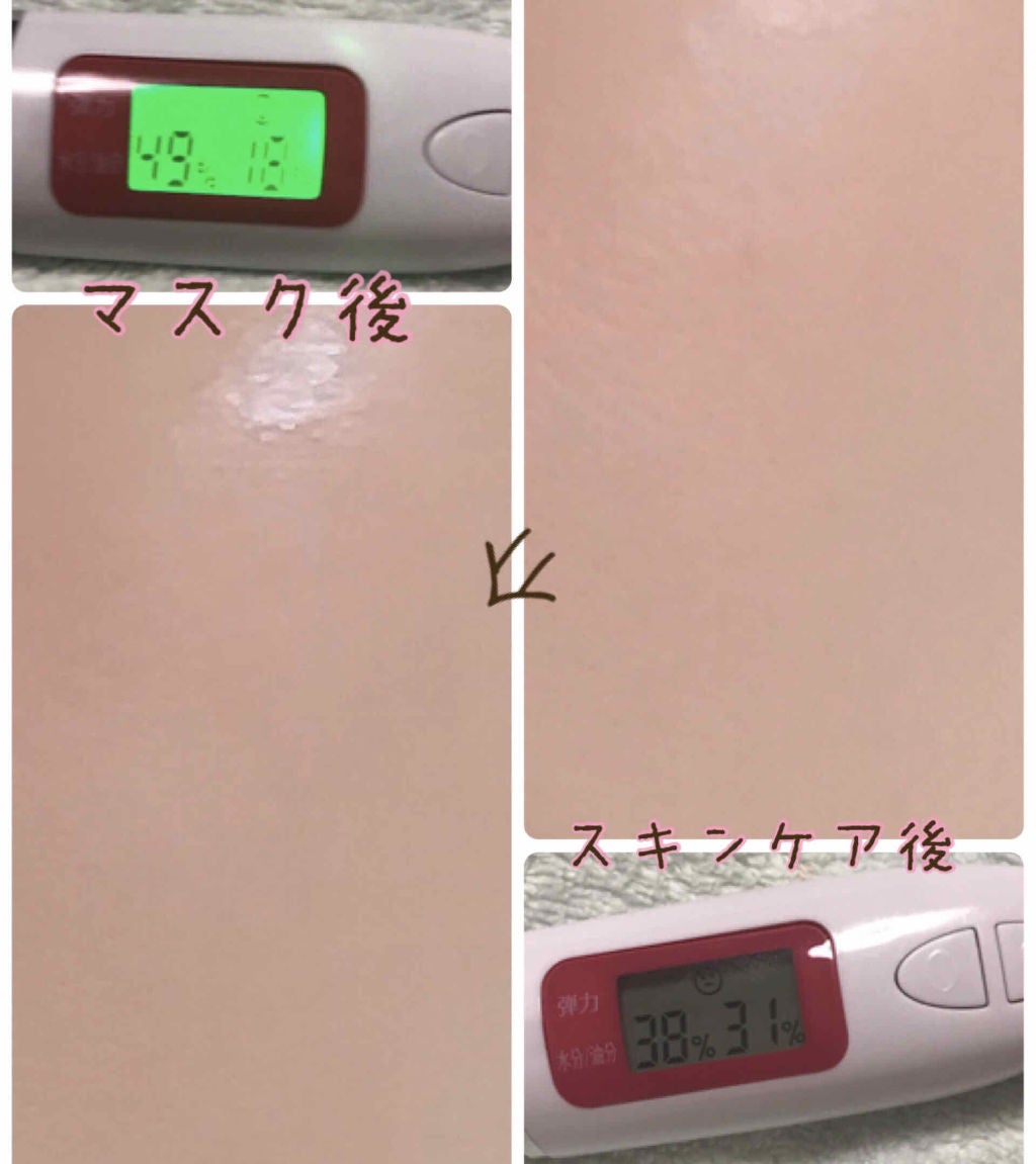 マイリアル スクイーズ マスクシート/innisfree/シートマスク・パックを使ったクチコミ(2枚目)