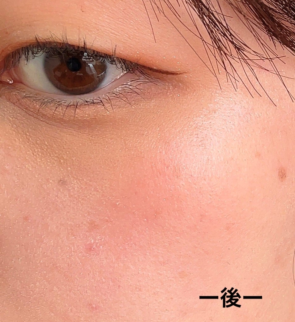 エッセンシャル リップチーク タップ/CLIO/ジェル・クリームチークを使ったクチコミ(10枚目)