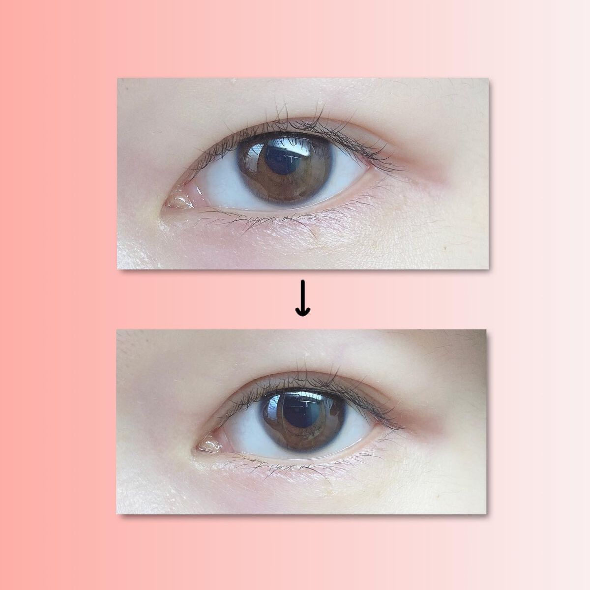 フリーファイバー120<下地&カッター付き>スタンダードタイプ 120本入/メザイク/二重まぶた用アイテムを使ったクチコミ(5枚目)