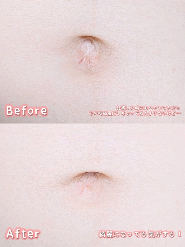 SPOT JELLY(スポッ!とジェリー)へそごまパック/花王/その他スキンケアを使ったクチコミ(8枚目)