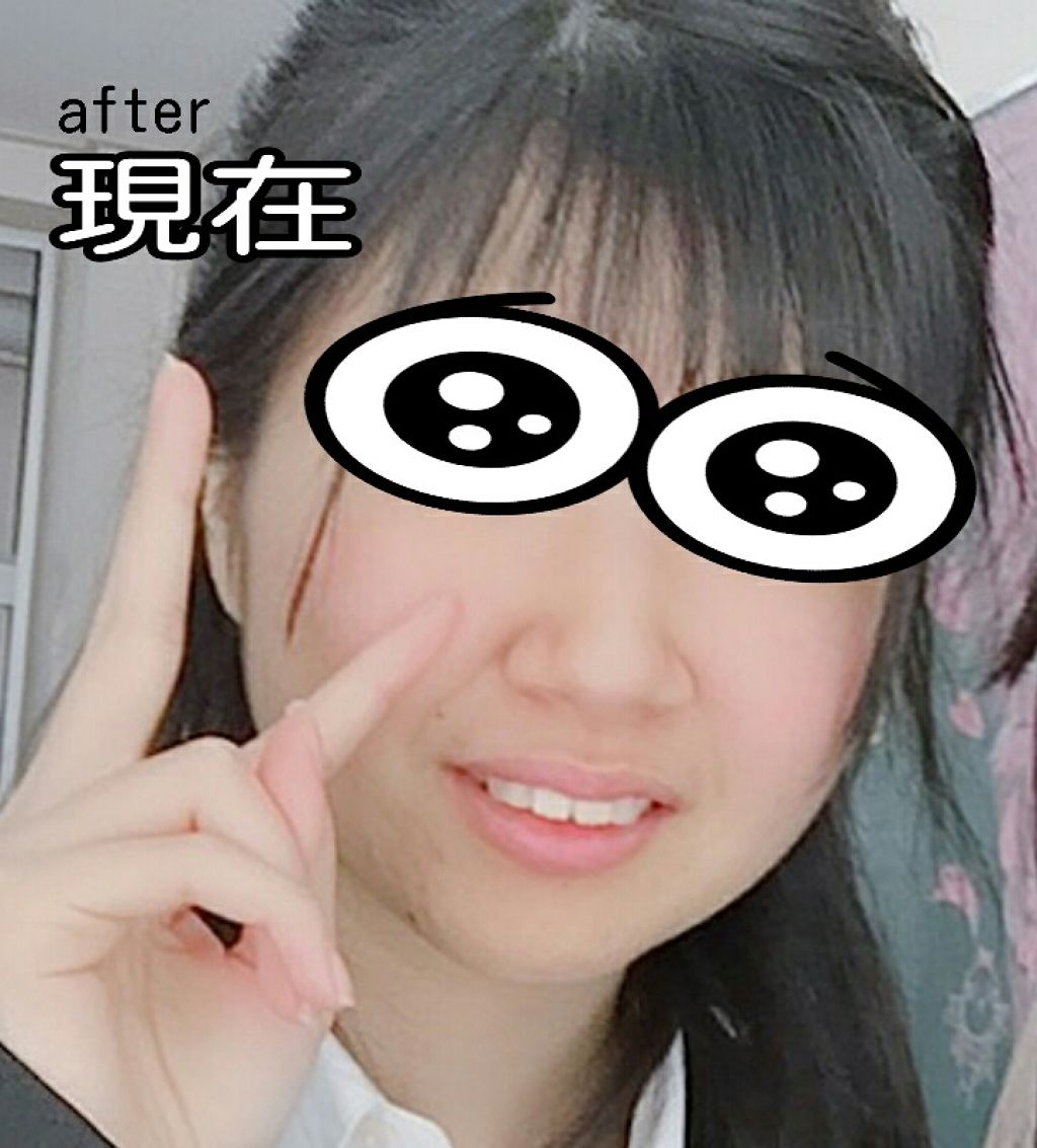 ハトムギ化粧水(ナチュリエ スキンコンディショナー R )/ナチュリエ/化粧水を使ったクチコミ（3枚目）