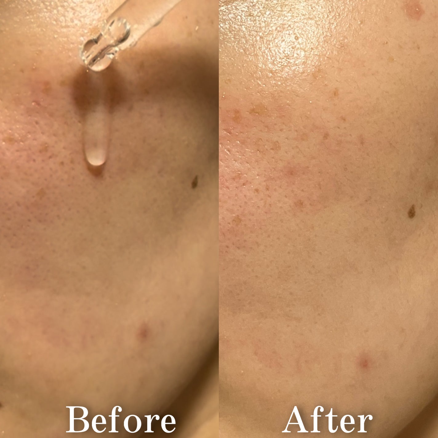 ノスカナイン トラブル セラム/FATION/美容液を使ったクチコミ(4枚目)