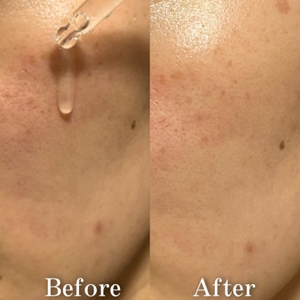 ノスカナイン トラブル セラム/FATION/美容液を使ったクチコミ(4枚目)